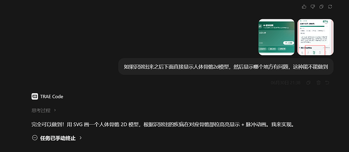 svg人体骨骼功能